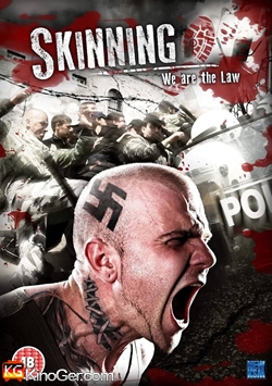 Skinning - Wir sind das Gesetz (2010)